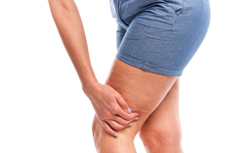 Cómo eliminar la grasa acumulada en las piernas: Consejos efectivos