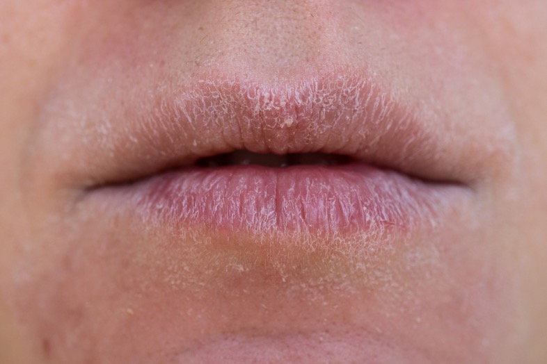 sequedad de boca y cansancio