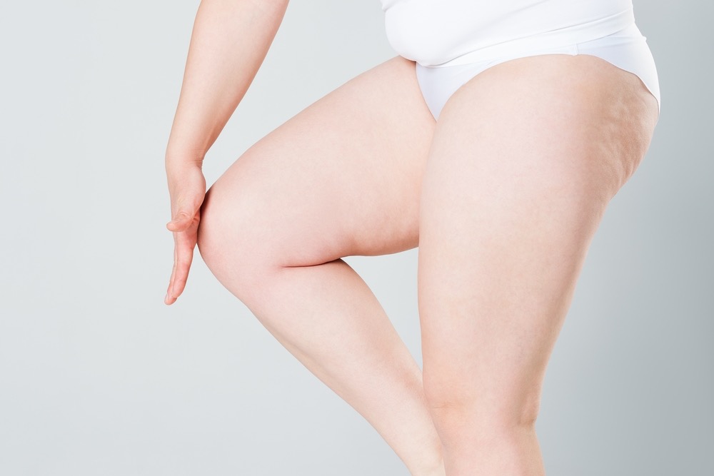Cómo eliminar la celulitis en la rodilla: Guía paso a paso