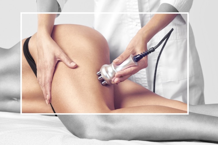 lipedema seguridad social