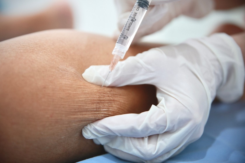 Sensibilidad en tejidos subcutáneos