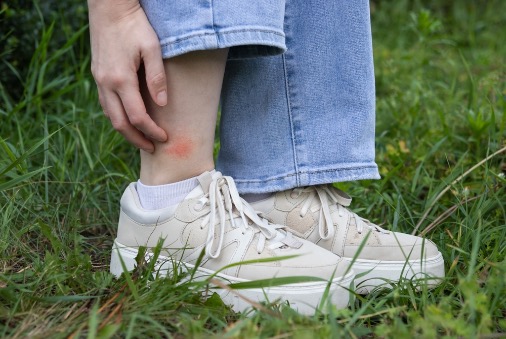 pinchazos en el tobillo en reposo