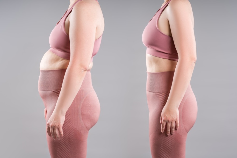 grasa en la cadera femenina