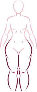 tipo de lipedema 3