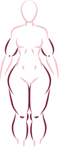 tipo de lipedema 4